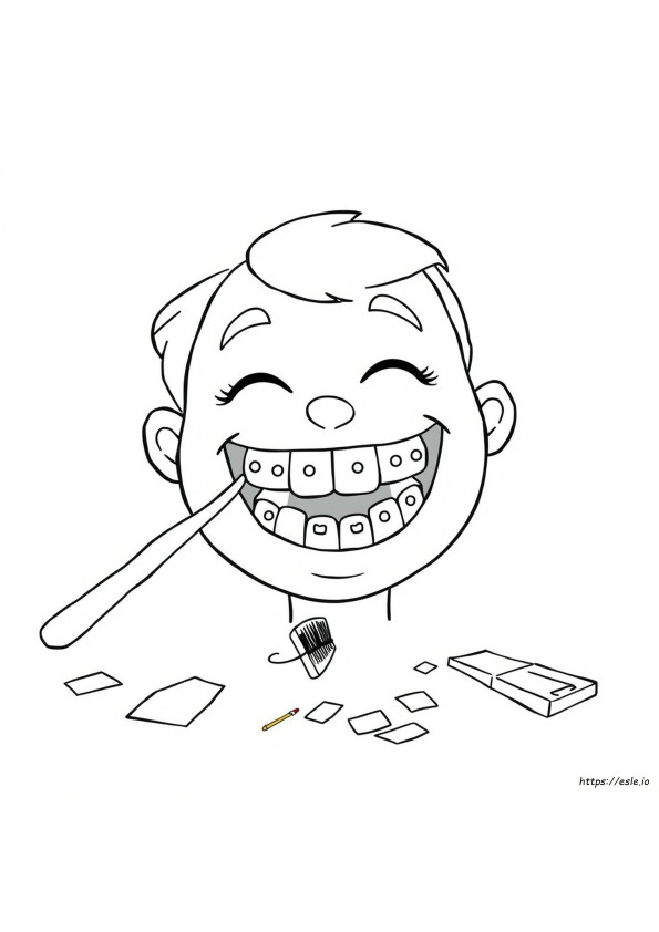 Braces Colors Options