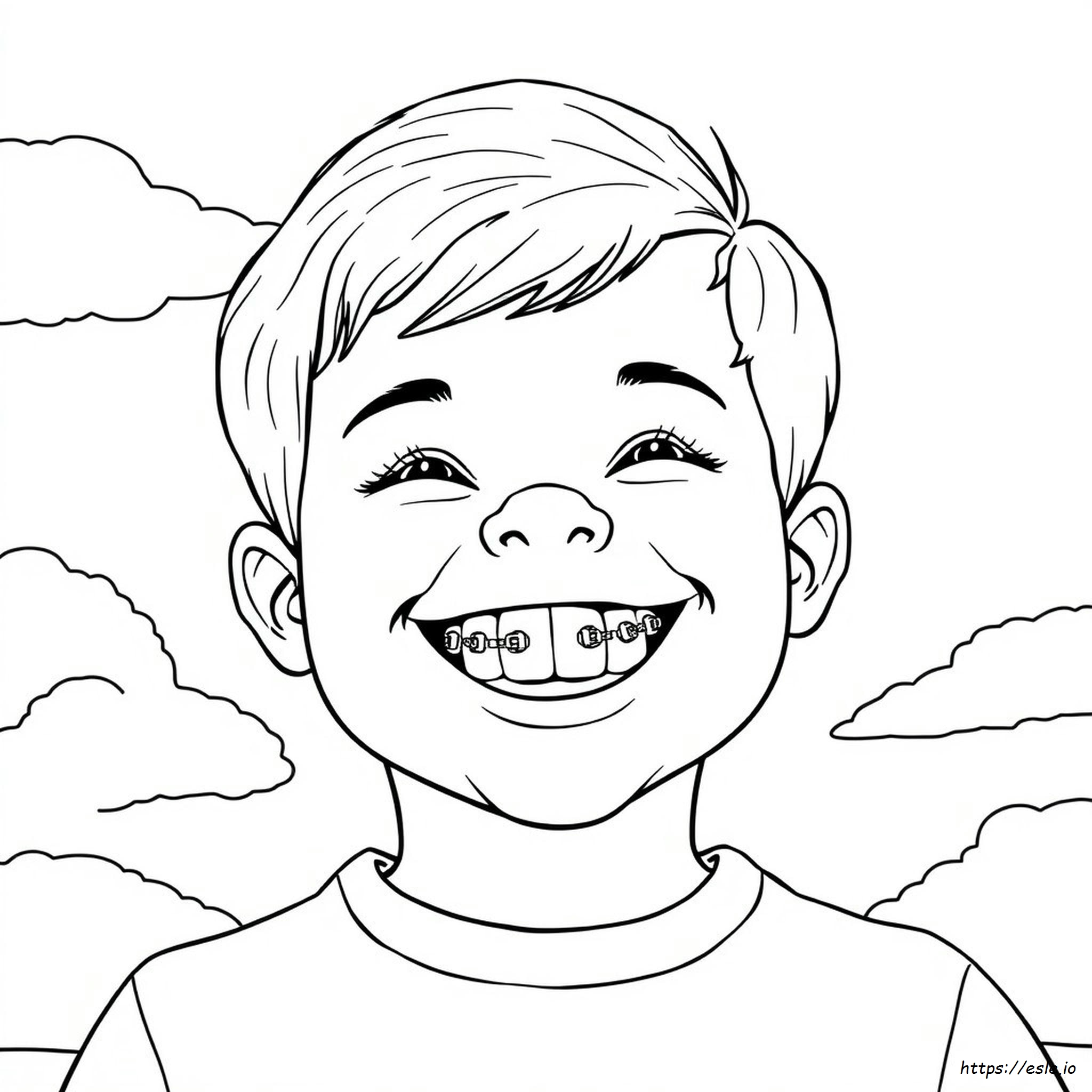 Braces Best Colors