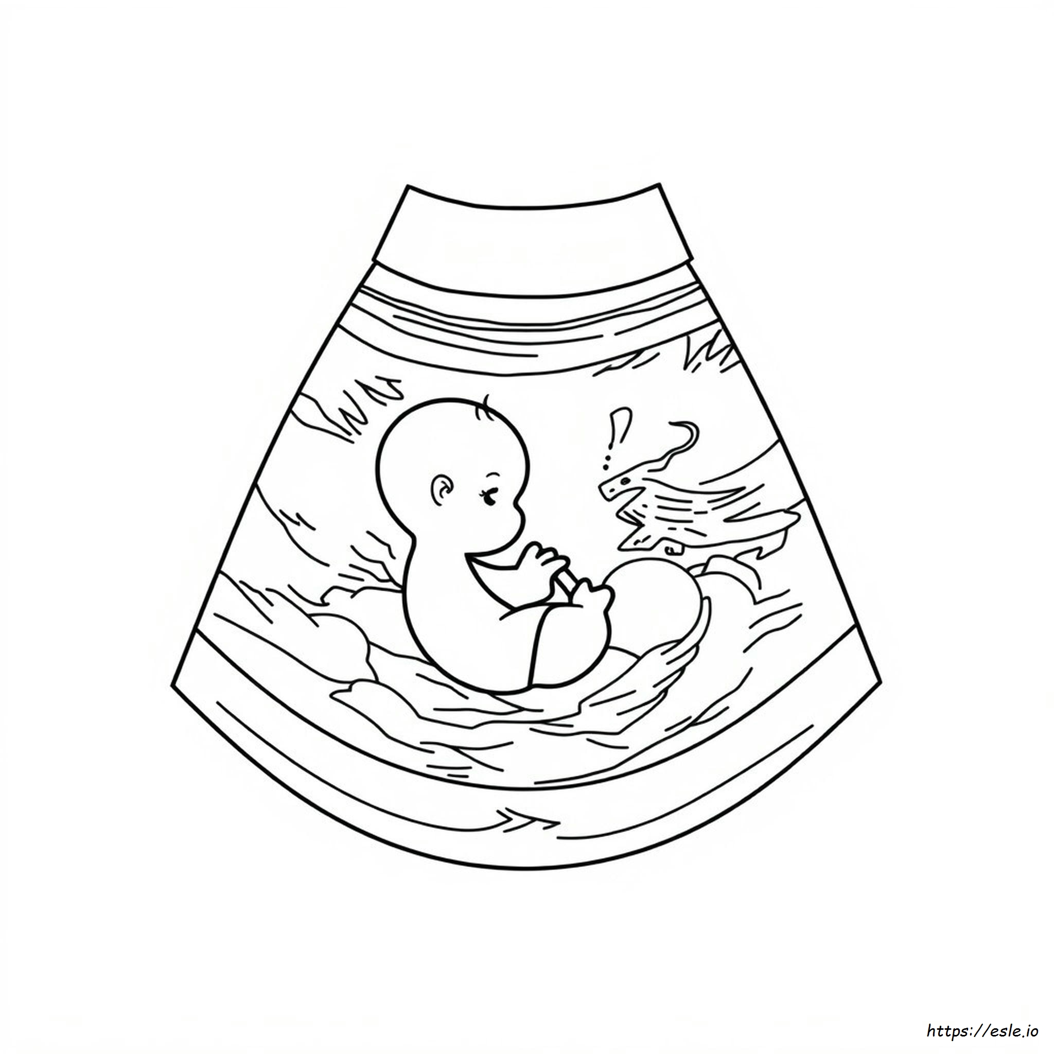 Kleur Echografieafbeeldingen kleurplaat